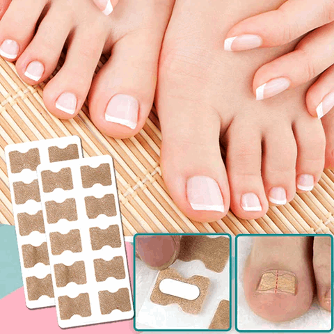 (50+50 FREE) FinePatches™ | Correction Patches for Beautiful and Healthy Nails | OFFER ENDS TODAY