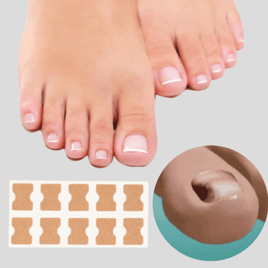 (50+50 FREE) FinePatches™ | Correction Patches for Beautiful and Healthy Nails | OFFER ENDS TODAY