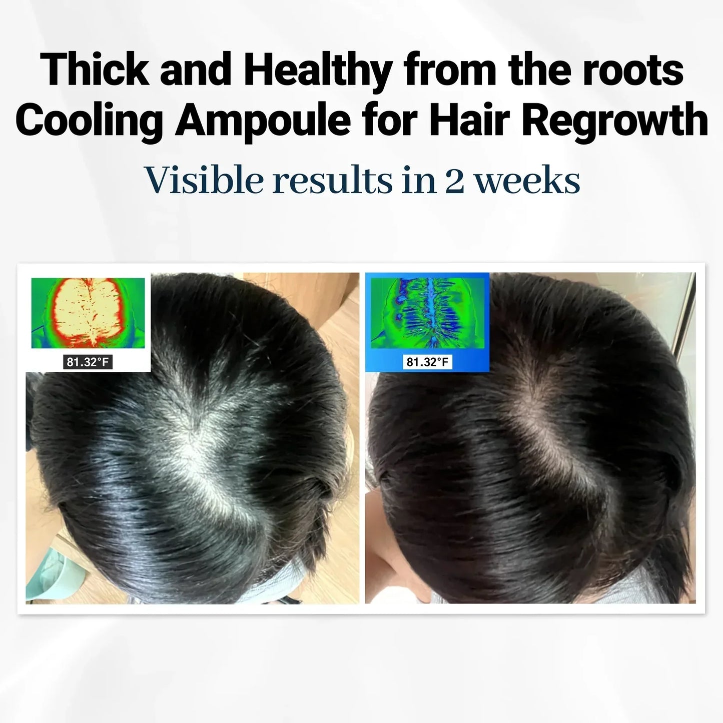 FolicleRevive™ - Korean Hair Growth Breakthrough That Regrows Lost Hair in Just 3 Weeks