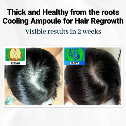 FolicleRevive™ - Korean Hair Growth Breakthrough That Regrows Lost Hair in Just 3 Weeks