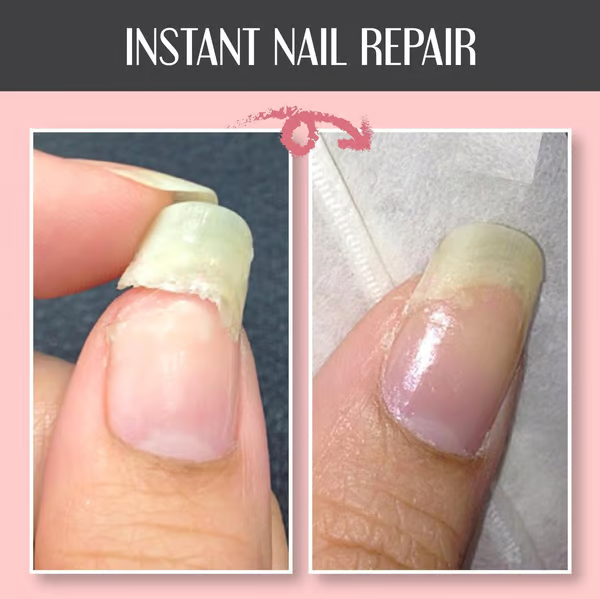 Repairing and Protecting Gel for Nails: Strengthens and Regenerates