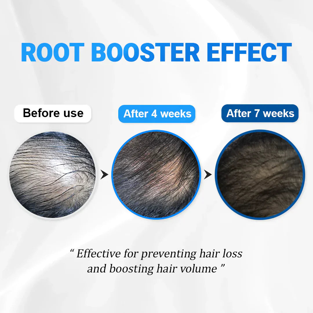 FolicleRevive™ - Korean Hair Growth Breakthrough That Regrows Lost Hair in Just 3 Weeks