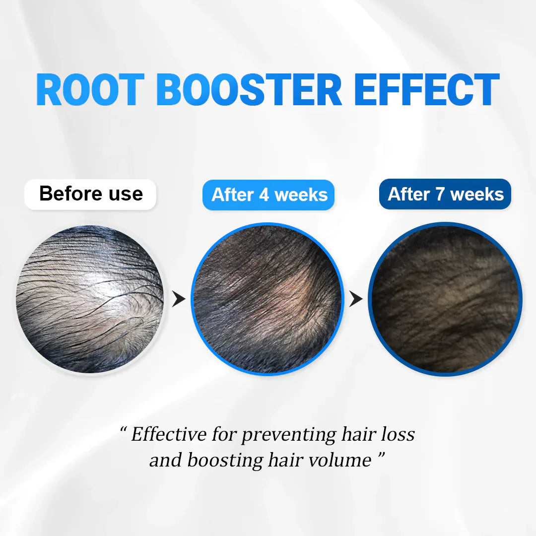 Hair Growth Serum