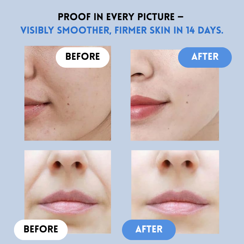 YouthLift™ Renew Strips – The Instant Solution for Timeless Beauty