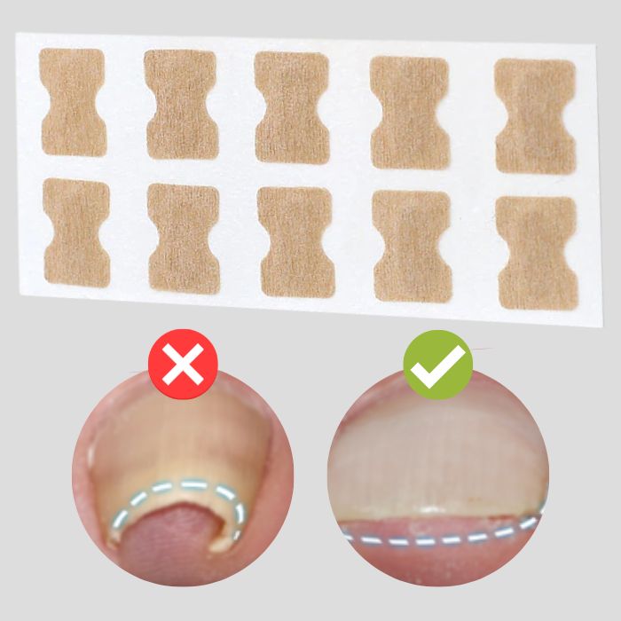 (50+50 FREE) FinePatches™ | Correction Patches for Beautiful and Healthy Nails | OFFER ENDS TODAY