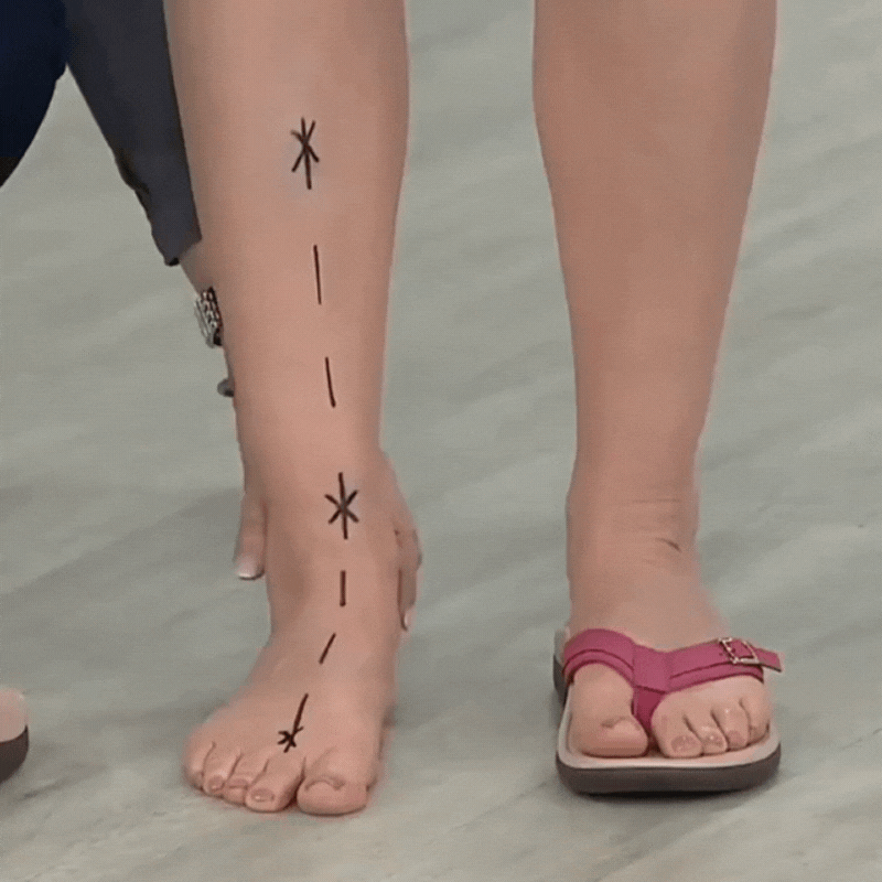 Pylera Orthopaedic Summer Sandals