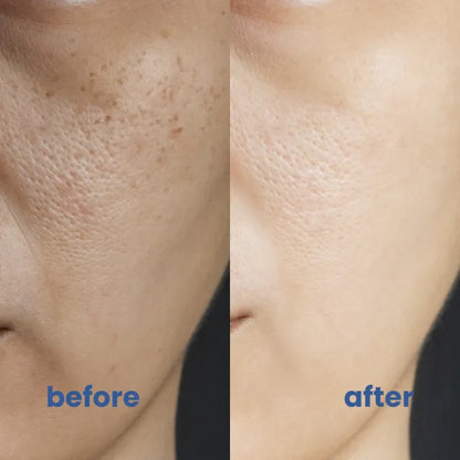 SkinGlow Perfect Coverage Solution