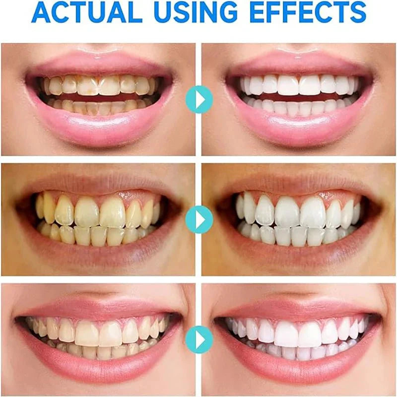 PureTeeth™ | Toothpaste for Bright, Healthy, and Confident Smiles
